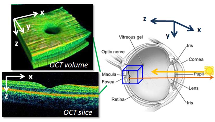 oct-image-volume-slice Diagram showing eye scan results with labeled 3D volume, slice view, and anatomical diagram of the eye highlighting scanning regions.