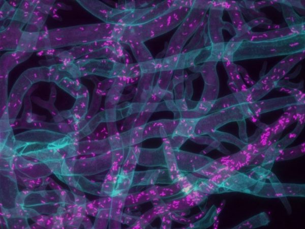 Bacteria in cells