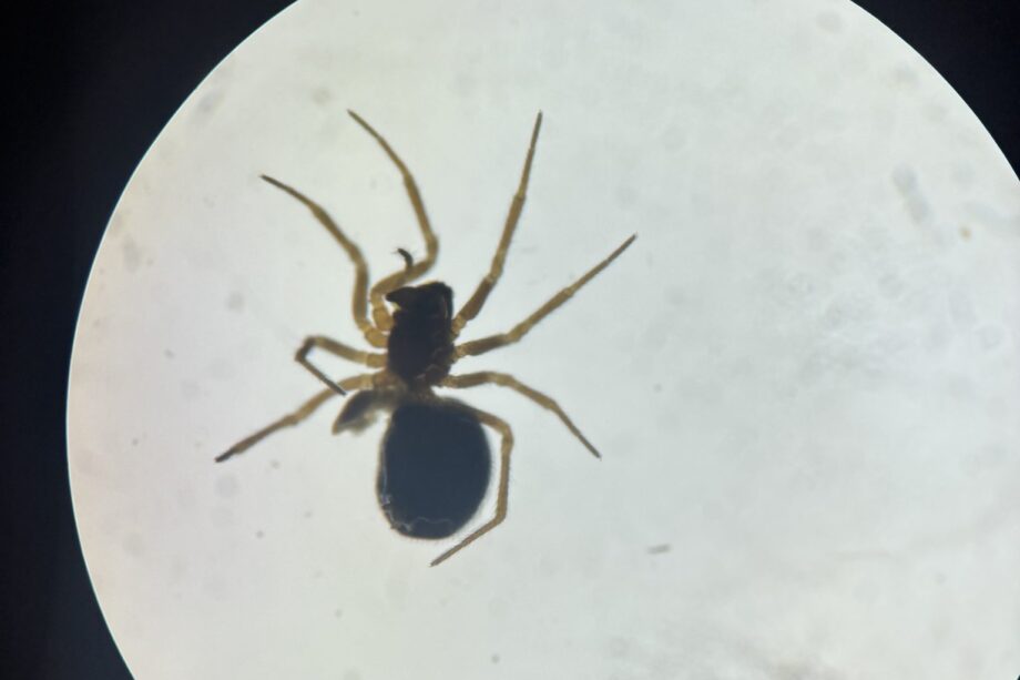Spider A magnified spider with a dark, rounded abdomen, smaller dark body, and eight slender yellowish-brown legs appears against the bright circular viewing field of a microscope.